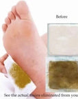 DIVERSE DEPOTโข - Kinoki Herbal Detox Foot Pads