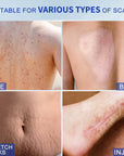 Silicone Scar Cream for Old and New Scars