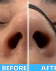 Nasal Strips | Pack Of 10