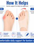 Freesize ToeFix Elastic Bunion Corrector