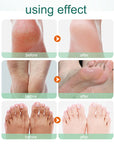 Foot Exfoliation Socks