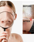 Nose Black Head Remover Strips