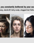 Anti-Dandruff Hollow Massage Hairbrush