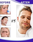Nasal Strips | Pack Of 10