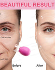 Silicone Vacuum Cupping Therapy
