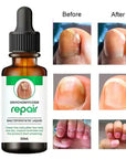Nail Serum for Repair & Growth