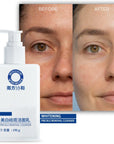 Whitening Facial Cleanser for Freckle Removal & Radiant