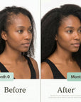 Hair Activator Oil