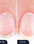 2 In 1 Nail Fungus Repair Pen