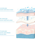 Hyaluronic Acid Microneedle Eye Patches(PAIR)