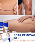 Silicone Scar Cream for Old and New Scars