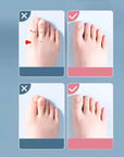 Soft Silicone Toe Spacer & Foot Corrector