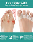 Soft Silicone Toe Spacer & Foot Corrector