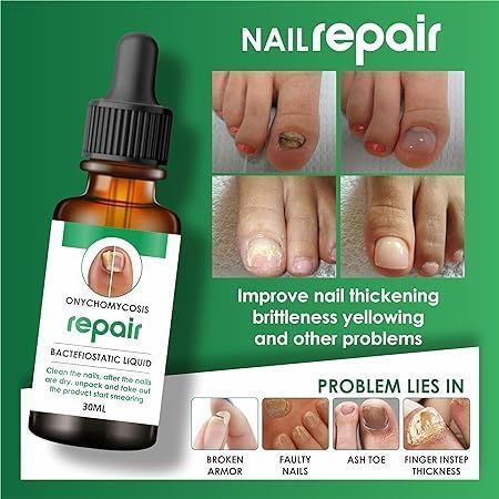 Nail Serum for Repair &amp; Growth