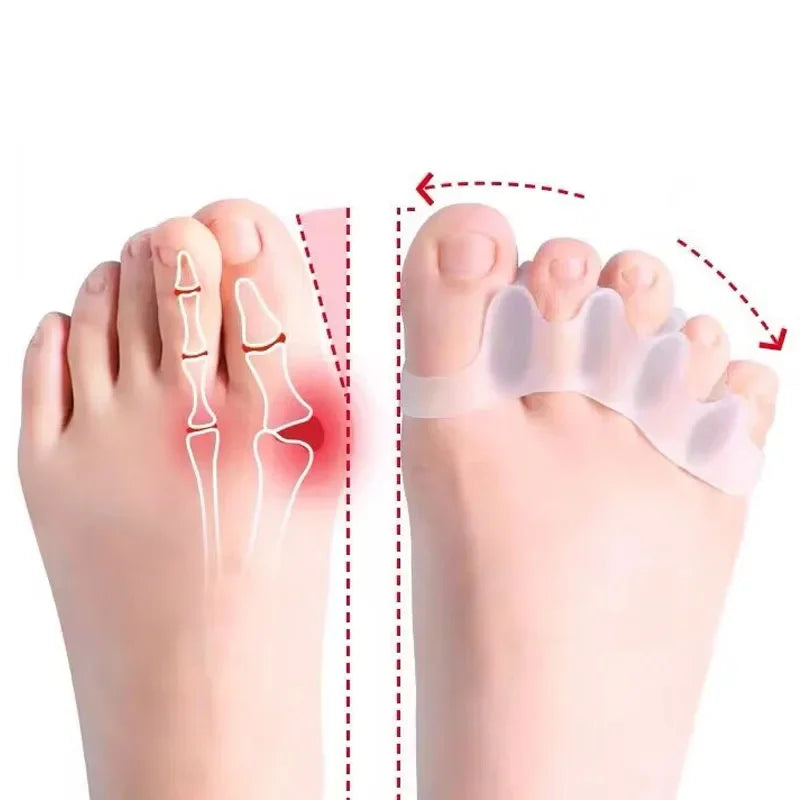 Soft Silicone Toe Spacer &amp; Foot Corrector