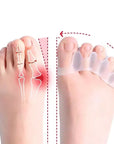 Soft Silicone Toe Spacer & Foot Corrector