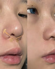 Dumbbell Nose Tip Patch Contouring Corrective Nose Patch