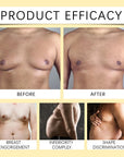Men Therm Bee Venom Gynecomastia Heating Oil