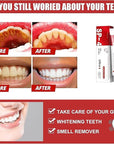 SP-4 Ultra+ Whitening Toothpaste