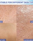 Silicone Scar Cream for Old and New Scars