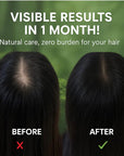 Natural Hair Growth Shampoo Bar