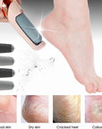 Rechargeable Electric Callus Remover – FREE Extra Roller + USB Charging Wire Included