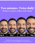 Perfora Purple Magic Whitening Toothpaste