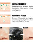 Nose Black Head Remover Strips