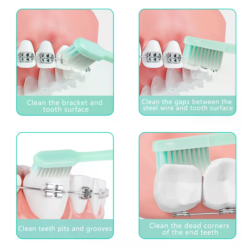 Portable U-shaped Soft Bristled Folding Toothbrush