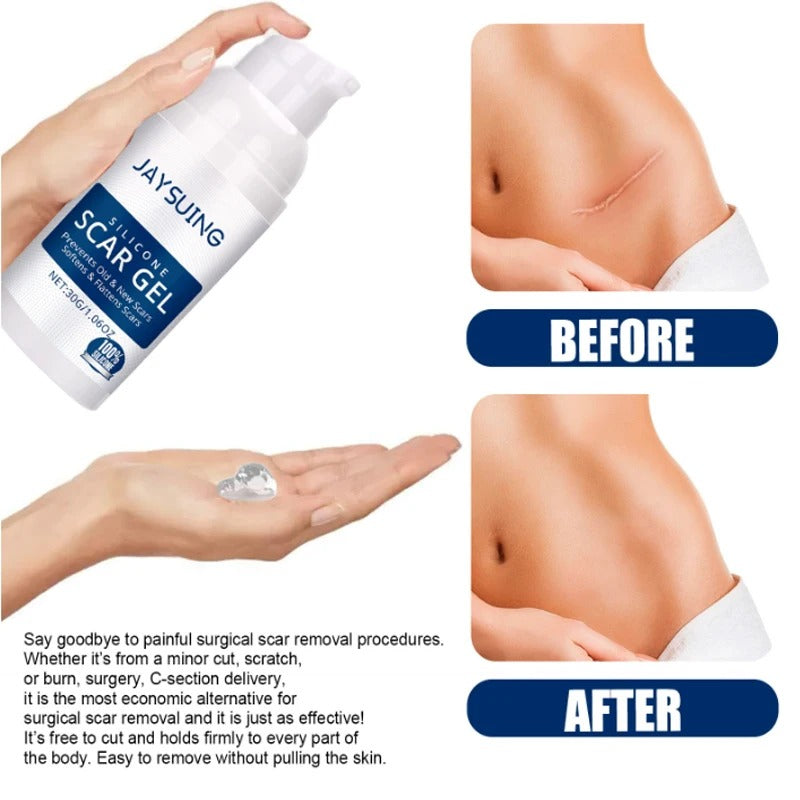 Silicone Scar Gel repair Old and New Scars