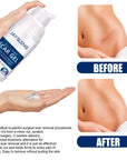 Silicone Scar Gel repair Old and New Scars