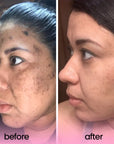 TURMERIC & KOJIC ACID PADS