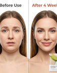 V Shape Face Mask