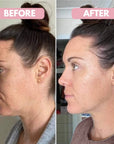 GLOWPOP™ GLASS FACIAL CUPS SET