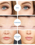 Hyaluronic Acid Microneedle Eye Patches(PAIR)