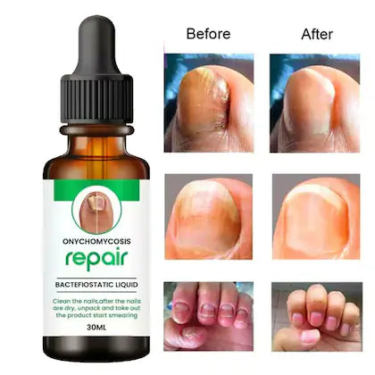 Nail Serum for Repair &amp; Growth