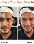 Men's Enzyme De-Tan Face Pack