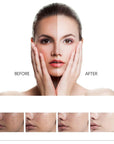 Whitening Facial Cleanser for Freckle Removal & Radiant