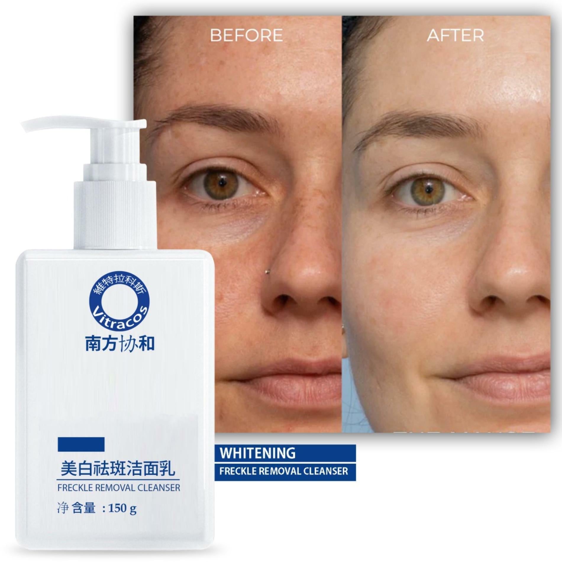 Whitening Facial Cleanser for Freckle Removal &amp; Radiant